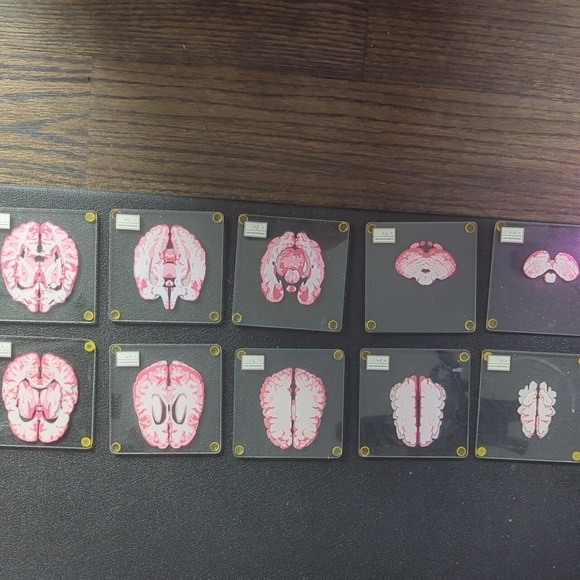 Glass Brain Coasters Set - Picture 2 of 4